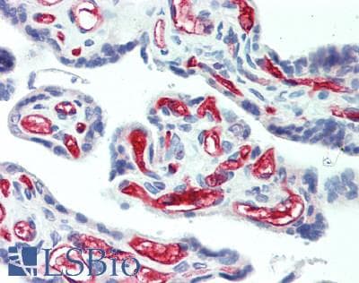 IHC-plus™ Polyclonal Rabbit anti-Human CD34 Antibody (IHC, IF, WB)