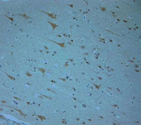 KCNJ13 / KIR7.1 Antibody (aa2-50)