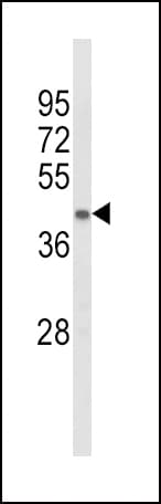 Polyclonal Rabbit anti-Human ACADL Antibody (aa292-319, IHC, WB)
