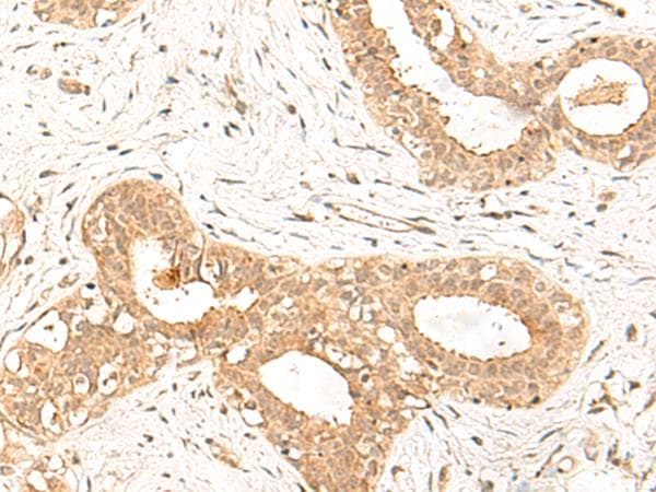 FBXL4 / FBL5 Antibody