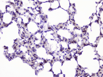 UBE2I / UBC9 Antibody