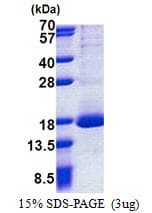 Human RPL30 / Ribosomal Protein L30 (Recombinant His)