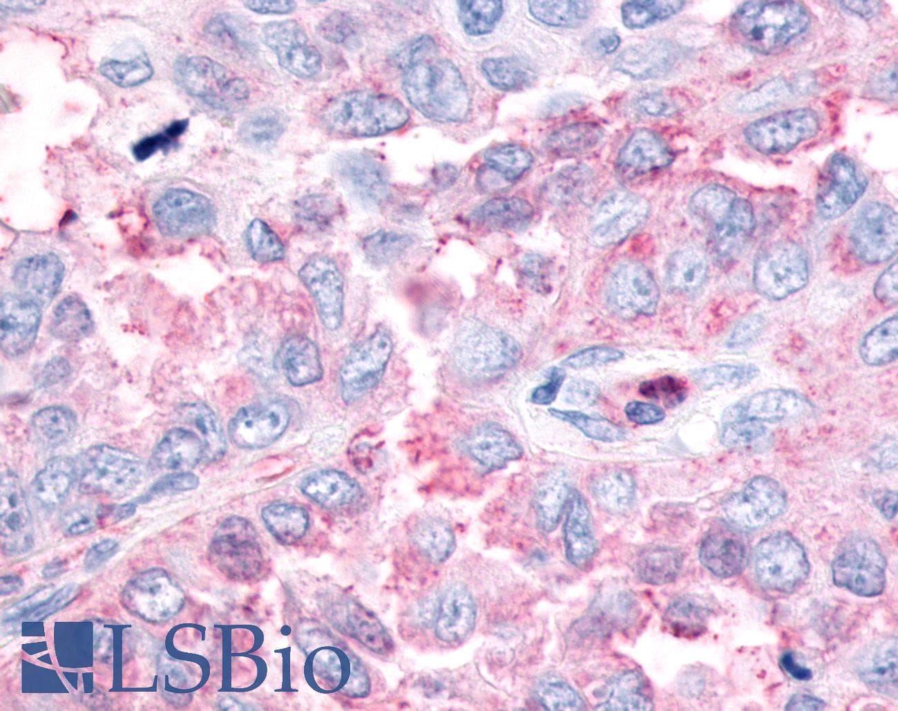 PathPlus™ Polyclonal Rabbit anti-Human ESRRG / ERR Gamma Antibody (N-Terminus, IHC)