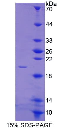 Bovine ANXA4 / Annexin IV Protein (Recombinant His-T7)