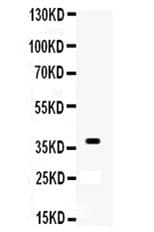 XRCC3 Antibody (aa290-305)