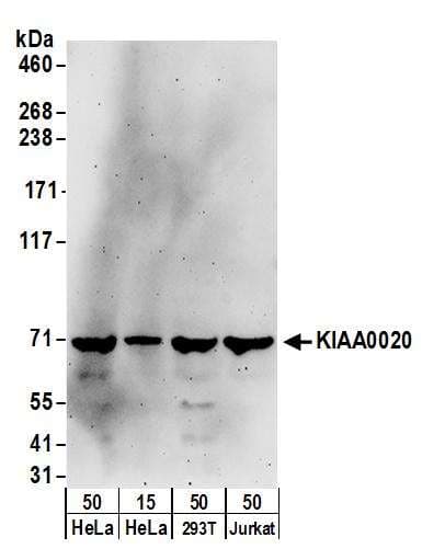 Polyclonal Rabbit anti-Human NOP14 / C4orf9 Antibody (aa750-800, WB)
