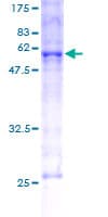 Human HMOX1 / HO-1 Protein (Recombinant GST)