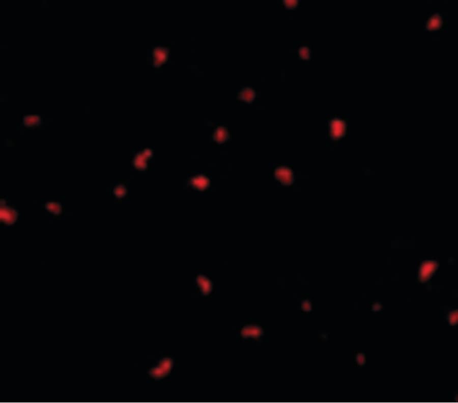 PAK6 Antibody