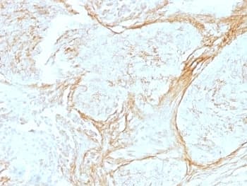 TNC / Tenascin C Antibody (clone SPM319, Azide-free, BSA-free)