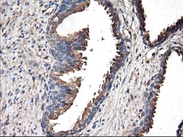 TUBAL3 Antibody (clone OTI4C5)