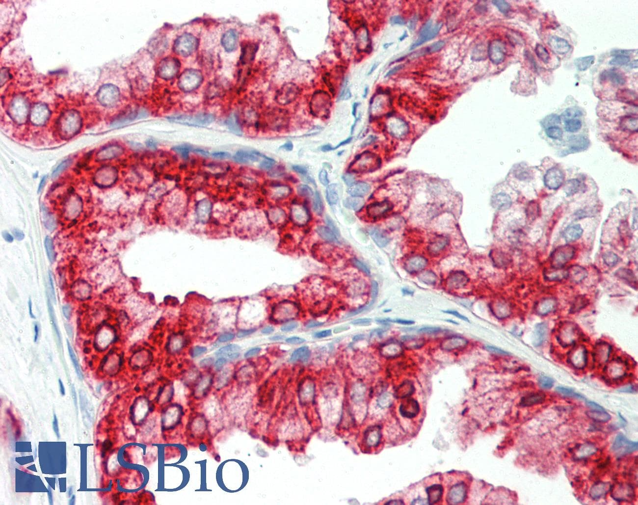 PathPlus™ AGR2 Antibody (aa21-175)