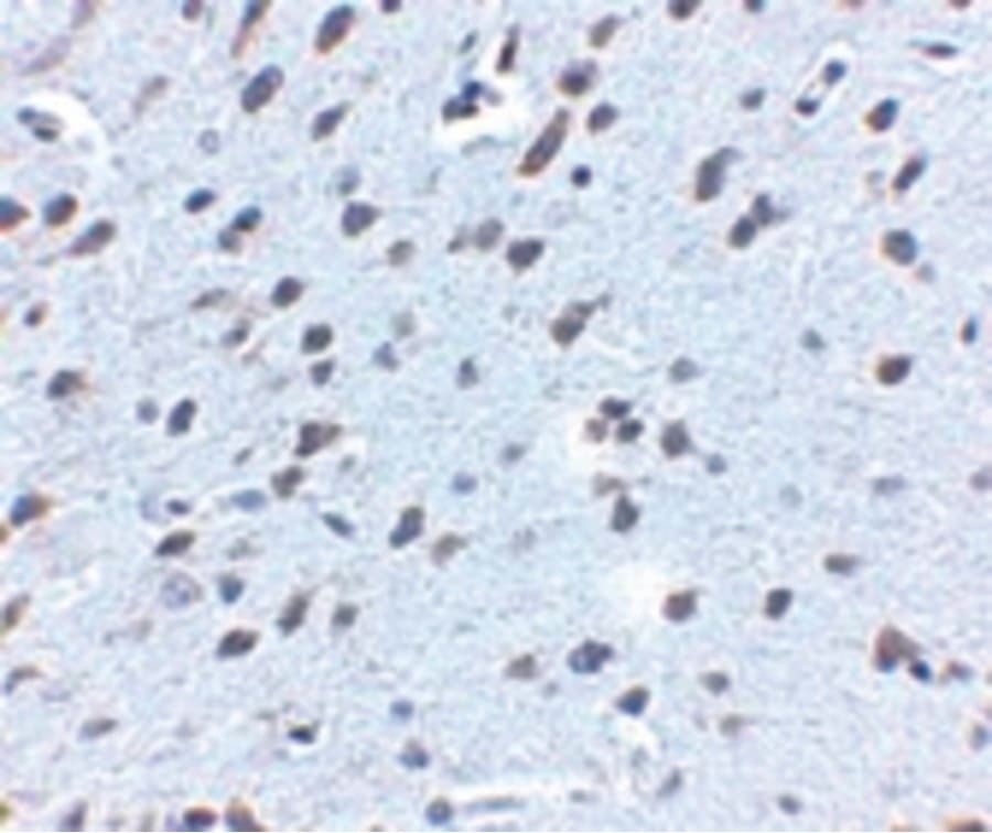 APP / Beta Amyloid Precursor Antibody