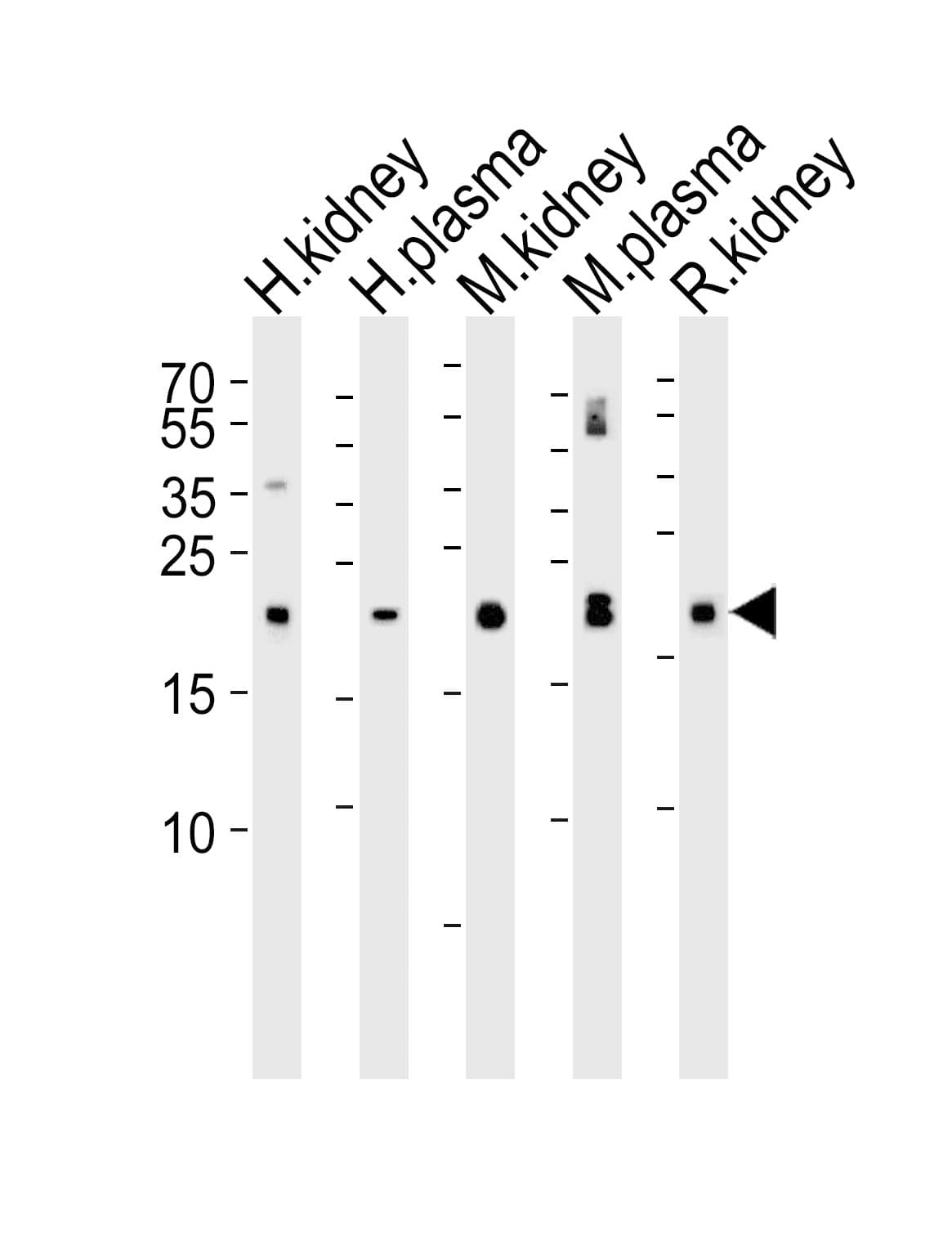 IHC-plus™ SLC29A1 / ENT1 Antibody (aa234-263)