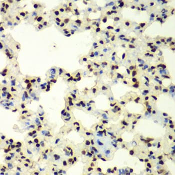 SUMO2 Antibody