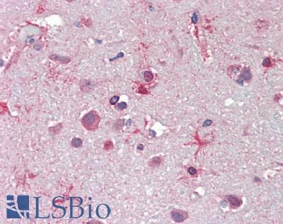 Monoclonal Mouse anti-Human MT3 / Metallothionein 3 Antibody (clone 3E8, IHC, WB)