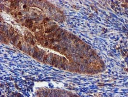 EPN2 Antibody (clone OTI1C2)