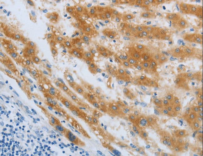 CHRNA7 Antibody