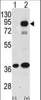 Polyclonal Rabbit anti-Human PROX1 Antibody (aa492-522, IHC, IF, WB)