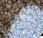 BCL2 / Bcl-2 Antibody