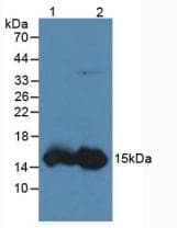 FABP1 / L-FABP Antibody (aa2-127, APC)