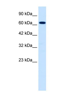 SCNN1B / ENaC Beta Antibody (C-Terminus)