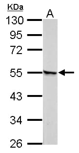 IHC-plus™ Polyclonal Rabbit anti-Human RARG / RAR-Gamma Antibody (IHC, WB)
