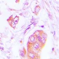 ADD1 / Adducin Alpha Antibody (Internal)