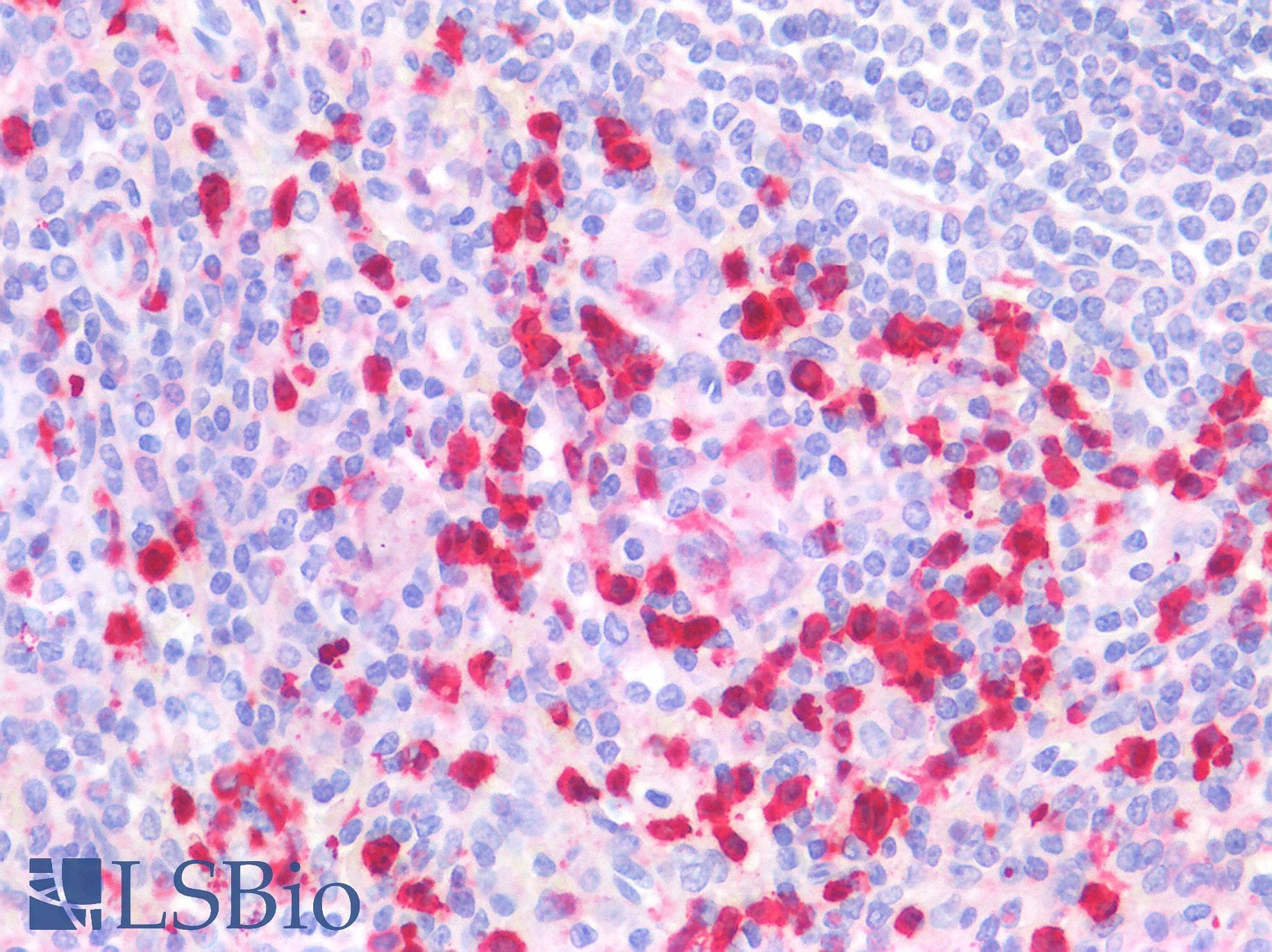IHC-plus™ Polyclonal Goat anti-Human S100A8 / MRP8 Antibody (aa49-62, IHC, WB)