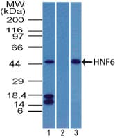 ONECUT1 / HNF6 Antibody (aa420-470)
