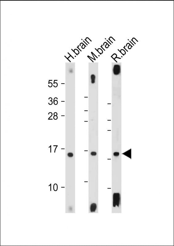 MAP1LC3A / LC3A Antibody