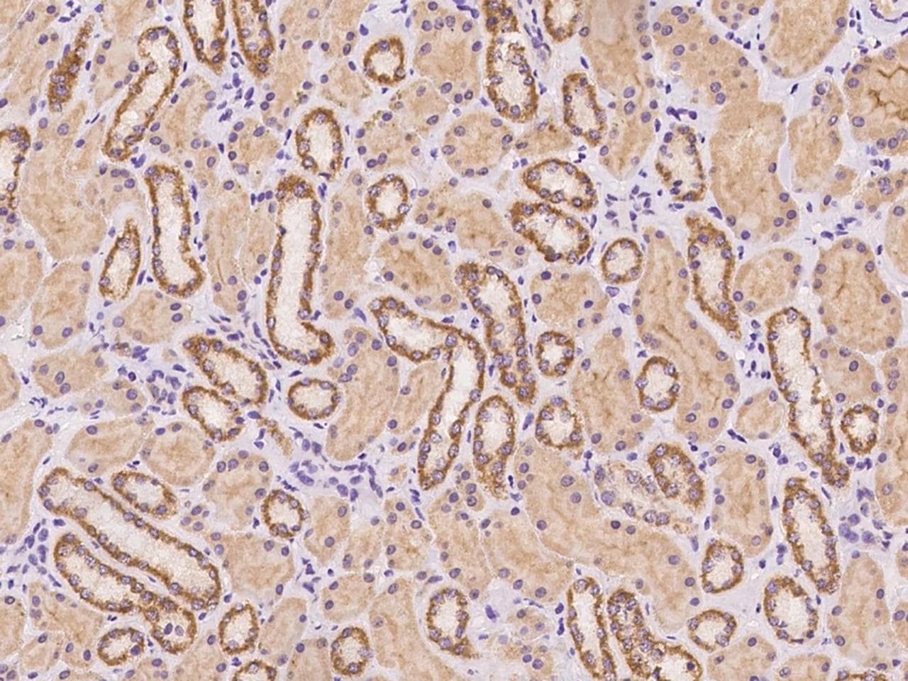 GALK2 Antibody (Preservative Free)