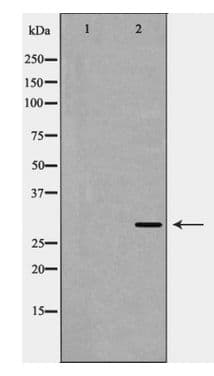 AQP1 / Aquaporin 1 Antibody