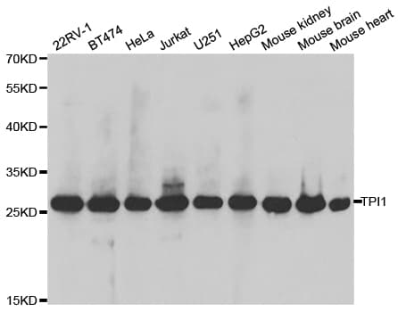 IHC-plus™ Polyclonal Rabbit anti-Human TPI1 / TPI Antibody (IHC, IF, WB)