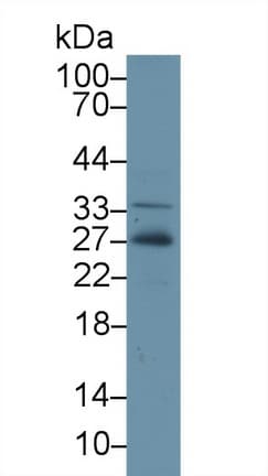 Adiponectin Antibody (aa32-244)