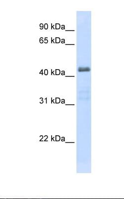 SLC29A2 / ENT2 Antibody (aa362-411)