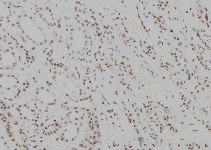 ZNF713 Antibody