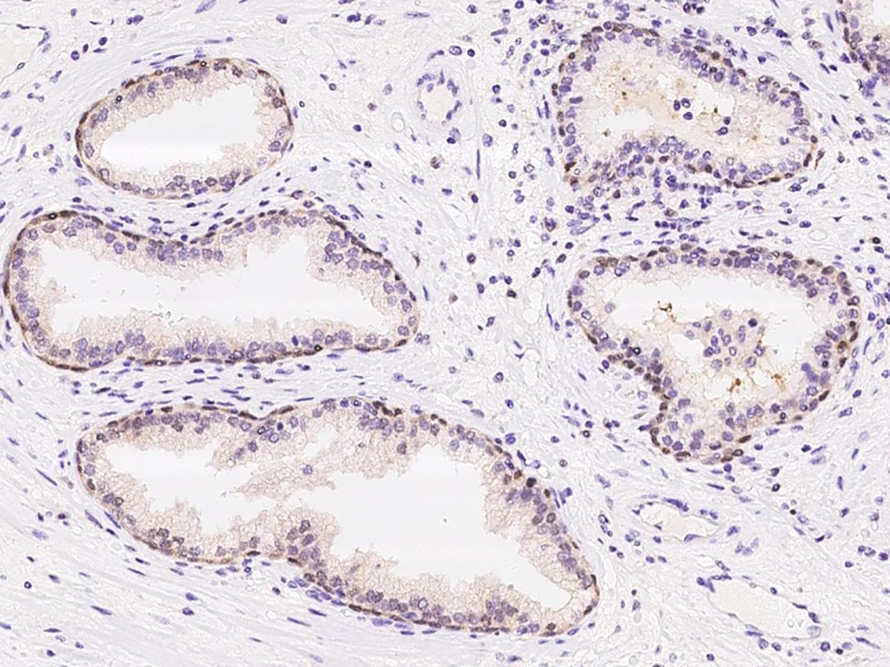PSPH Antibody (Preservative Free)