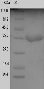 Escherichia coli Translocated intimin receptor protein (Recombinant 6His-SUMO, N-terminus)