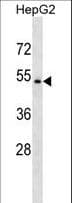 Polyclonal Rabbit anti-Human NR1H4 / FXR Antibody (aa18-46, WB)