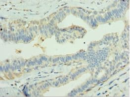 Polyclonal Rabbit anti-Human LGI1 Antibody (aa35-285, IHC)