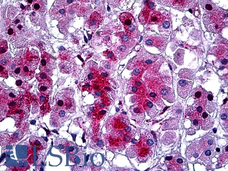 PathPlus™ Alpha-1-Antichymotrypsin Antibody (clone 1C10)