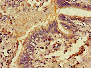 Polyclonal Rabbit anti-Human MICU2 / EFHA1 Antibody (IHC)