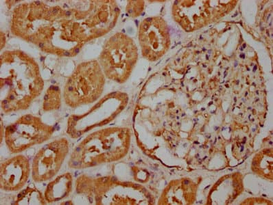 Polyclonal Rabbit anti-Human RASSF6 Antibody (IHC)