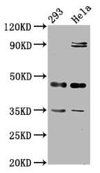 TES / Testin Antibody (aa130-260)