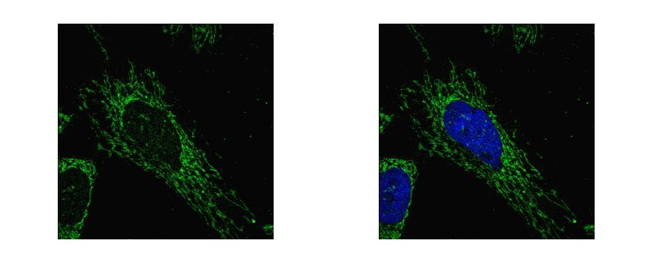 SUCLG1 / GALPHA Antibody (aa1-346)