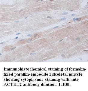 Polyclonal Rabbit anti-Human ACTRT2 Antibody (IHC)