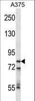CPSF3 / CPSF Antibody (aa192-221)