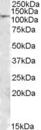 IHC-plus™ MTHFD1 Antibody (aa137-150)
