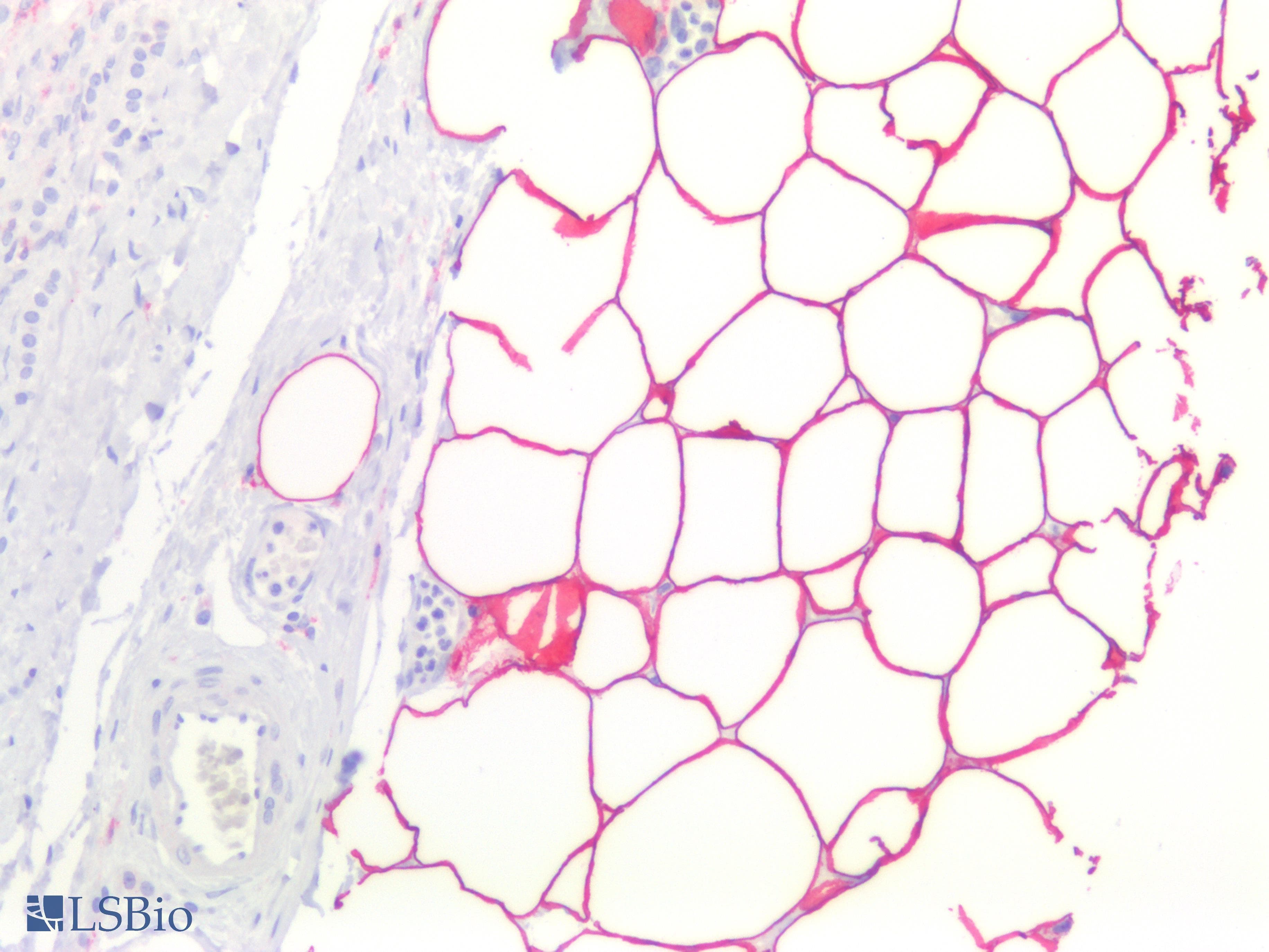IHC-plus™ Polyclonal Rabbit anti-Human FBP / FOLR2 Antibody (aa25-55, IHC, WB)