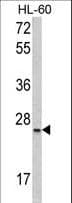 SRSF1 / SF2 Antibody (aa158-186)